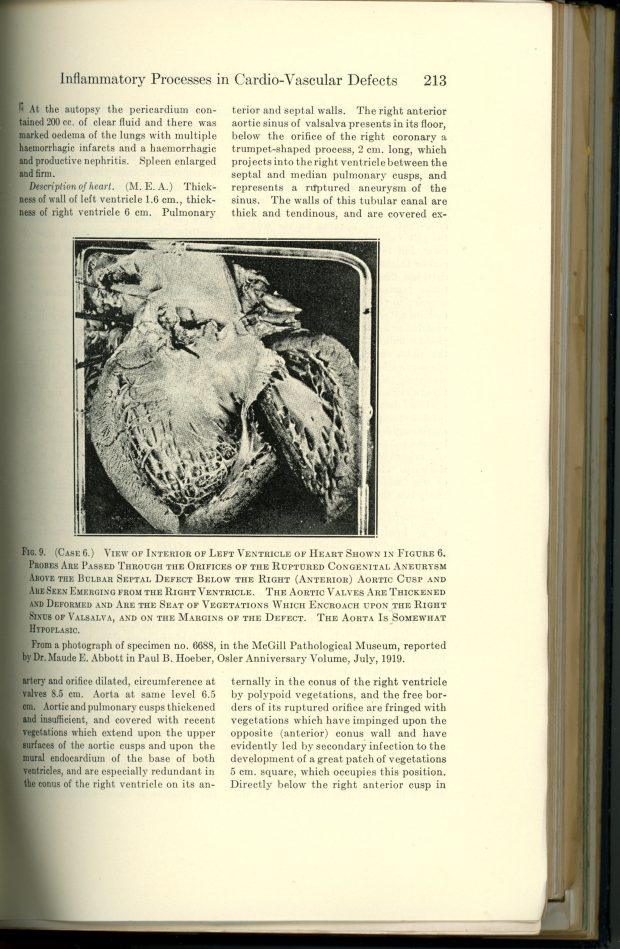 Page 203 d’un ouvrage de Maude Abbott sur l’effet des inflammations bactériennes sur les processus cardiovasculaires. En haut, le titre « Inflammatory Processes in Cardio-Vascular Defects ». Un texte en deux colonnes explique les différents processus. Au centre, une photographie en noir et blanc d’une vue de l’intérieur du ventricule gauche d’un cœur.