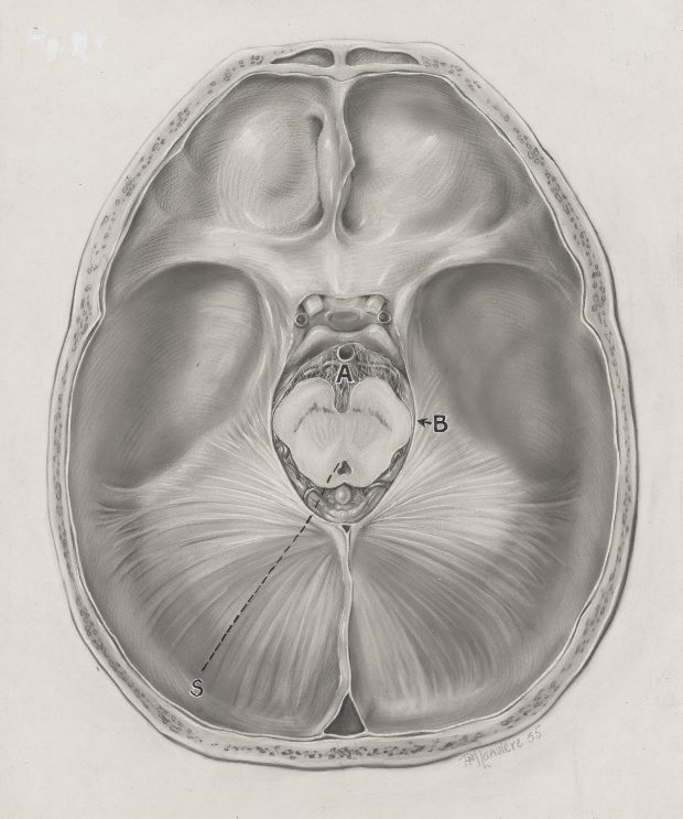 Dessin à la poudre de carbone en noir et blanc représentant une section du cerveau, réalisé par Pauline Larivière.