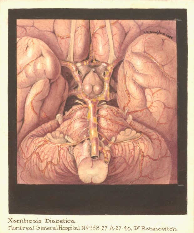 Illustration médicale représentant des organes internes dans des tons rouges et orangés. Le dessin est bordé d'une bordure noire et signé en haut à droite.