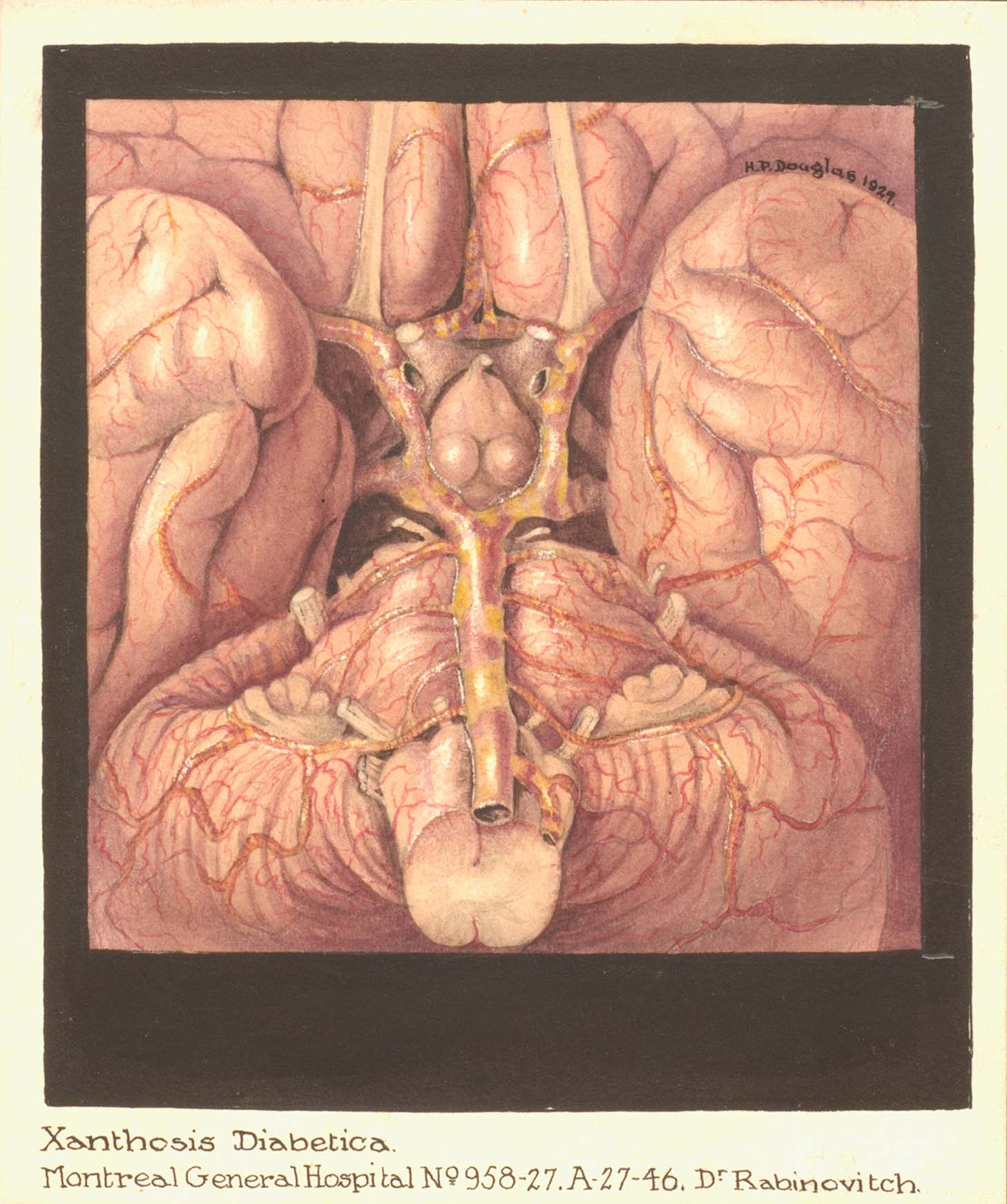 Illustration médicale représentant des organes internes dans des tons rouges et orangés. Le dessin est bordé d'une bordure noire et signé en haut à droite. 