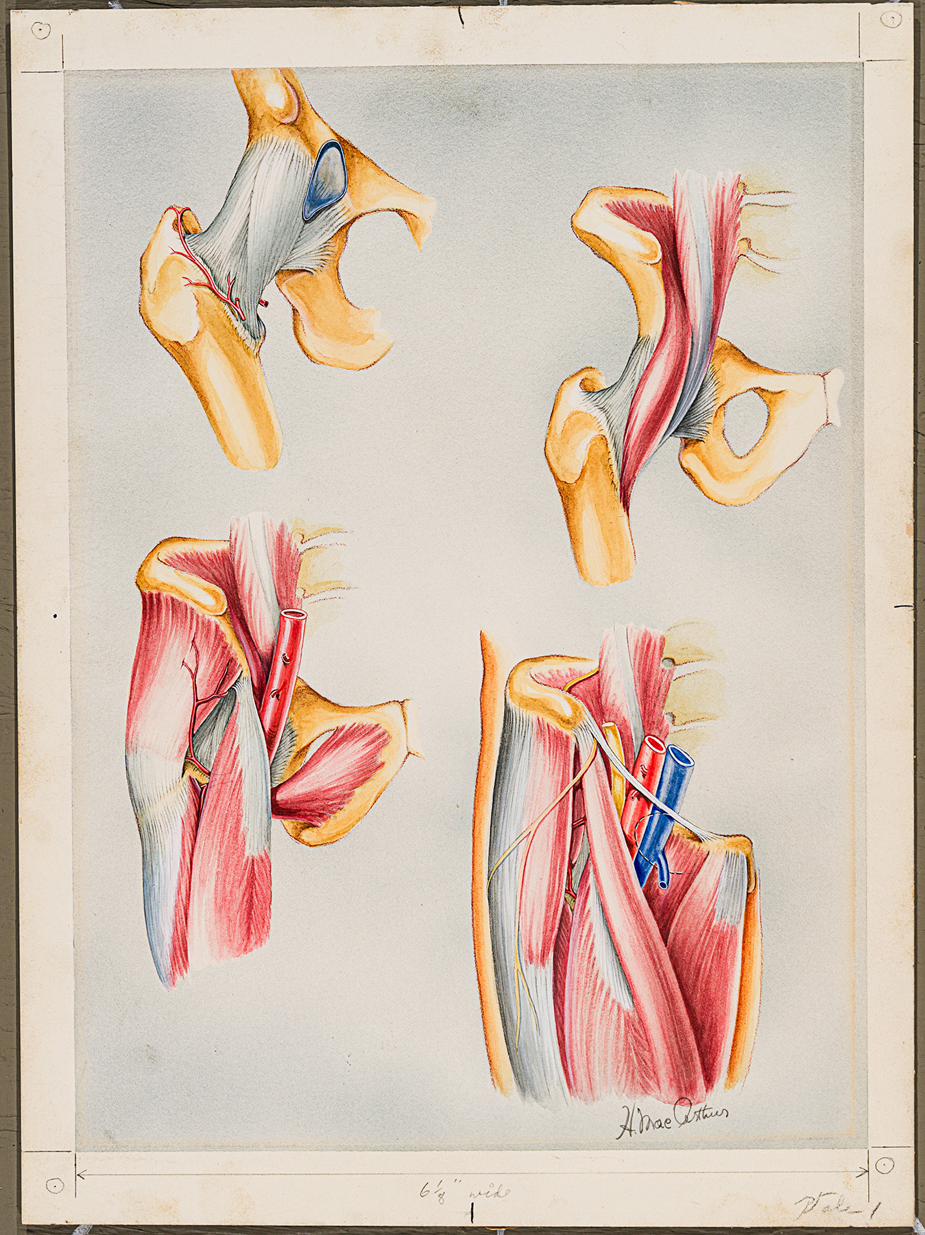 Illustration médicale en couleur montrant les muscles et les ligaments de la hanche, réalisée par Helen MacArthur. 