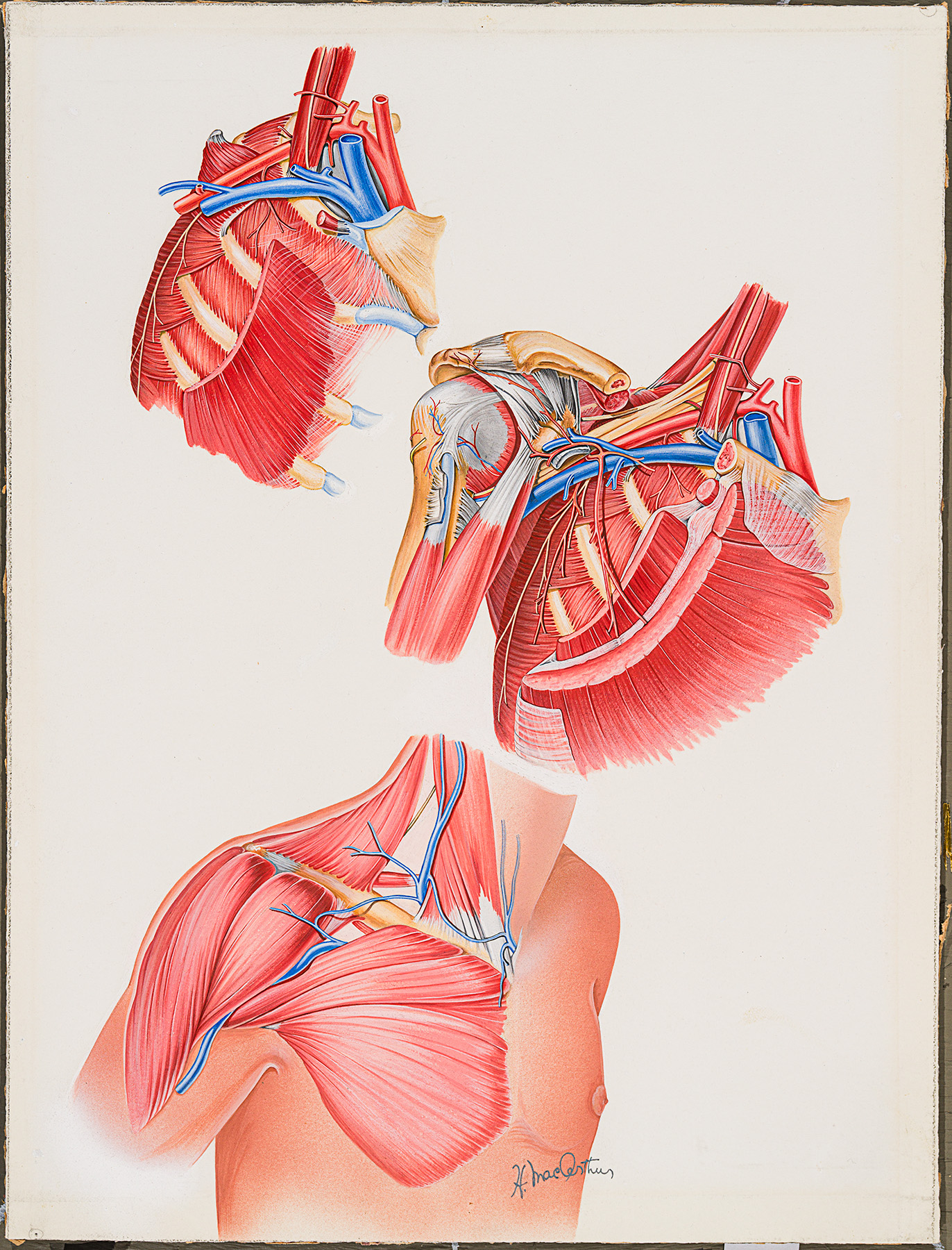 Illustration médicale en couleur montrant les muscles et les ligaments de l'épaule, réalisée par Helen MacArthur. 