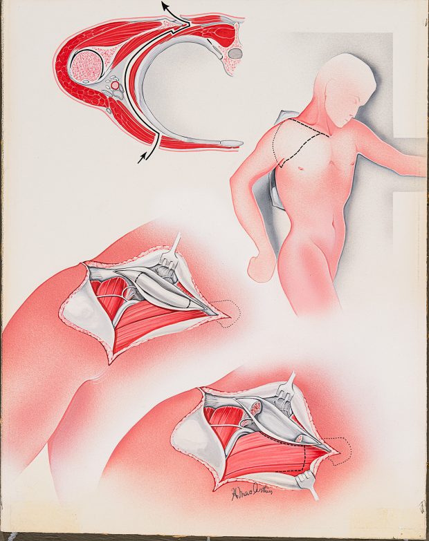 Illustration médicale en couleur montrant les muscles et les ligaments de l'épaule, réalisée par Helen MacArthur.