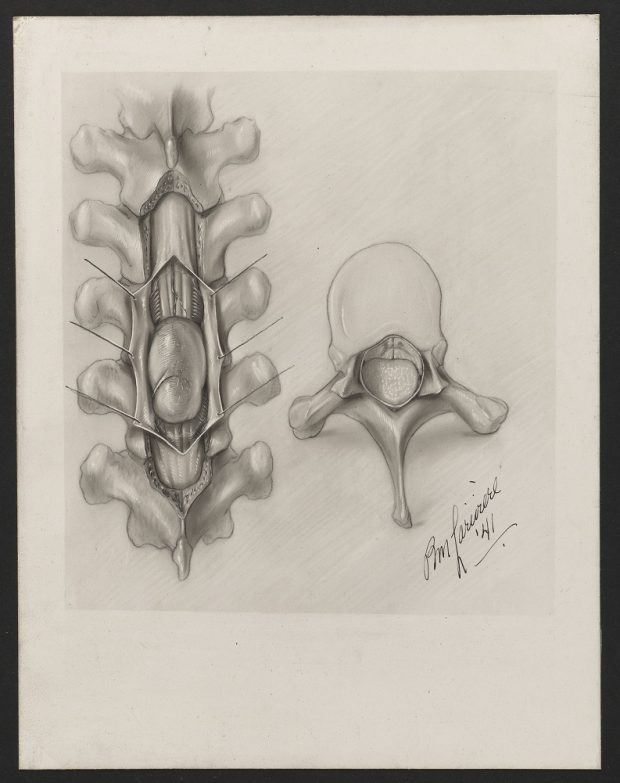 Croquis en noir et blanc d'une colonne vertébrale avec une vertèbre isolée à côté. En bas à droite, la signature stylisée de Pauline Larivière, 1941.