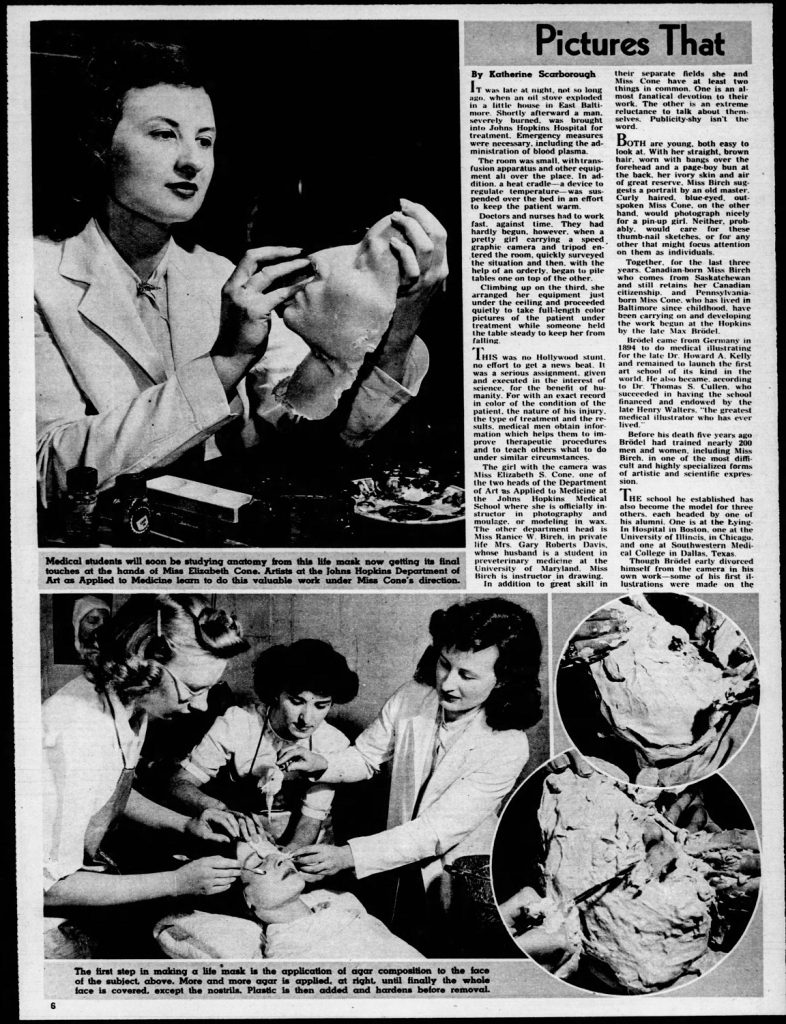 Article de journal anglophone en noir et blanc titré « Imaginez ça », montrant des femmes réalisant des moulages médicaux et prenant l'empreinte du visage d'une femme.