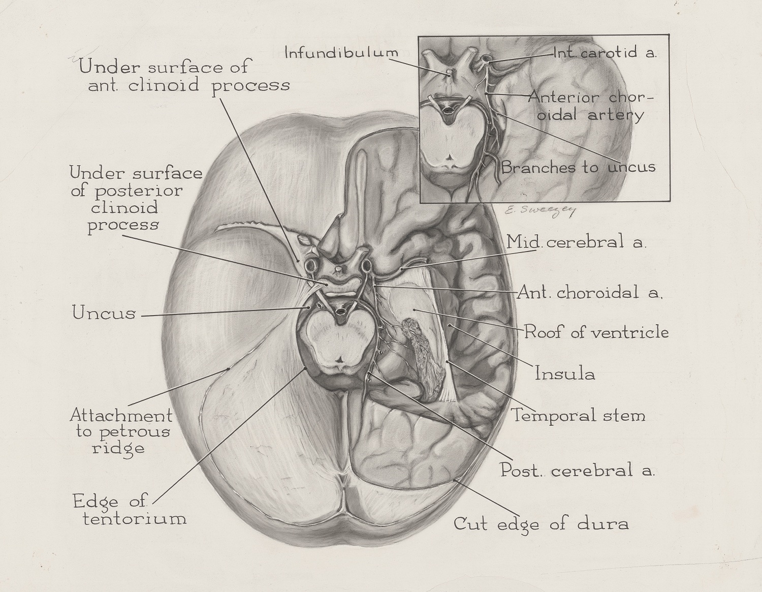 Illustration en noir et blanc d'une section transversale du cerveau. 
