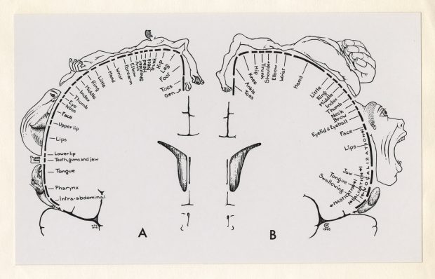 Esquisse en noir et blanc d'un cerveau. À l'intérieur du cerveau, des tirets et des annotations manuscrites. Des dessins au crayon de parties anatomiques exagérées entourent le cerveau.