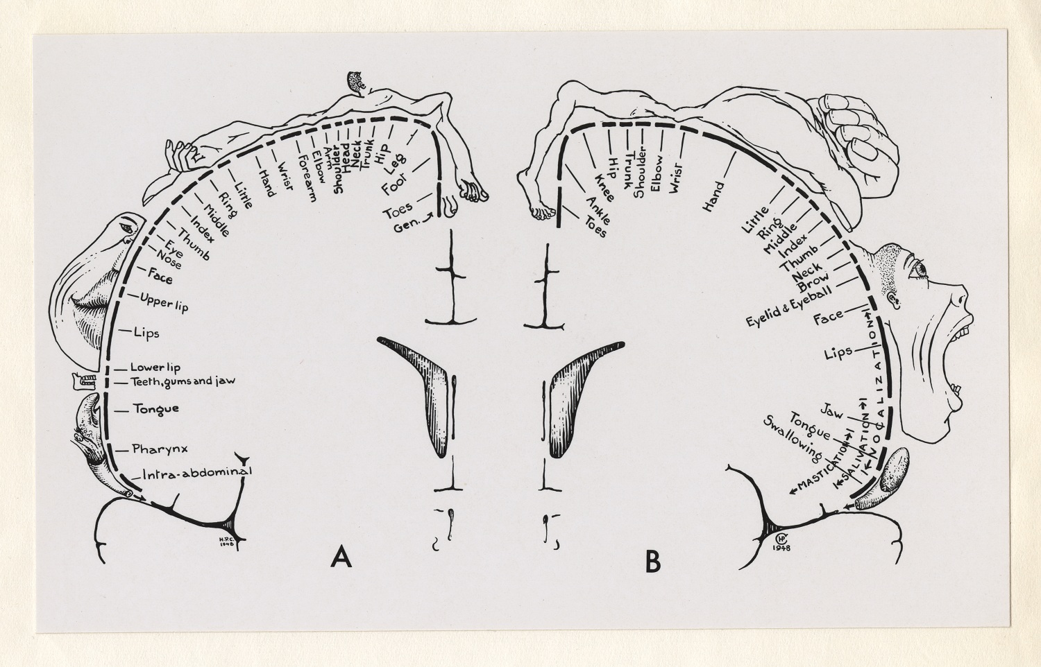 Esquisse en noir et blanc d'un cerveau. À l'intérieur du cerveau, des tirets et des annotations manuscrites. Des dessins au crayon de parties anatomiques exagérées entourent le cerveau. 