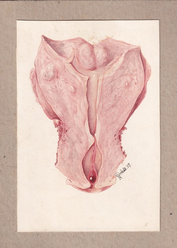 Illustration médicale réalisée à l'aquarelle dans des teintes roses et rouges sur fond crème, signée en bas à droite.
