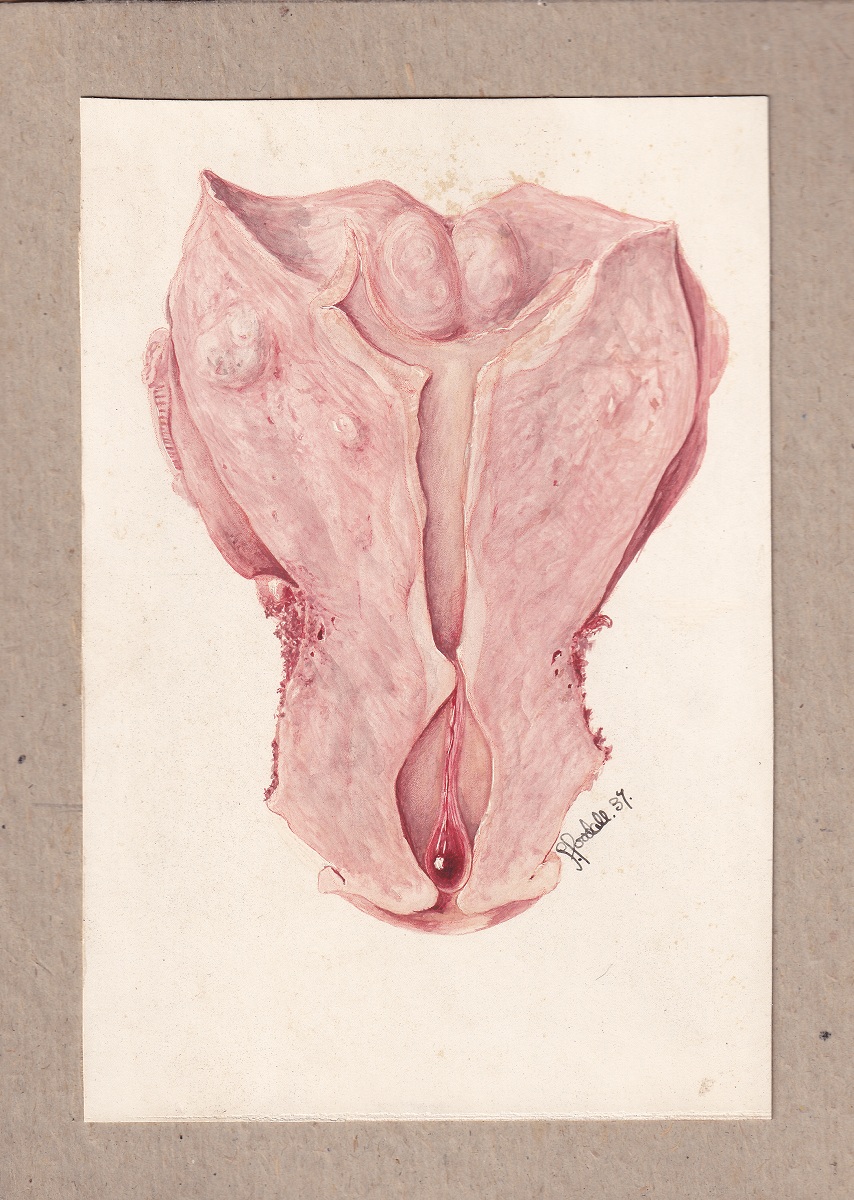 Illustration médicale réalisée à l'aquarelle dans des teintes roses et rouges sur fond crème, signée en bas à droite. 