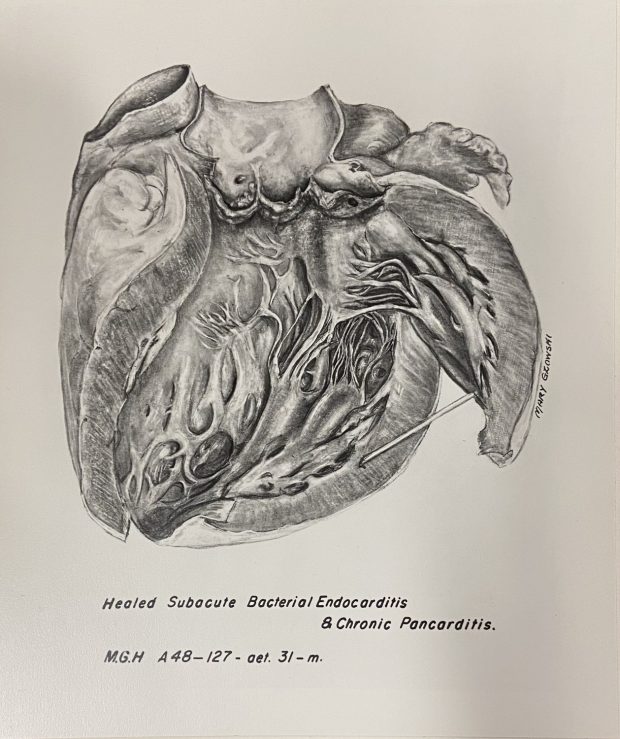 Illustration en noir et blanc d'un cœur, sectionné en deux et ouvert.
