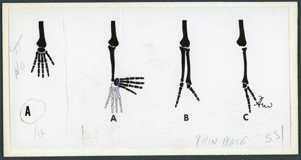 Illustration en noir et blanc des os de la main en différentes articulations.