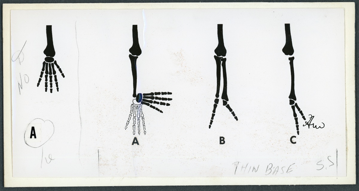 Illustration en noir et blanc des os de la main en différentes articulations. 