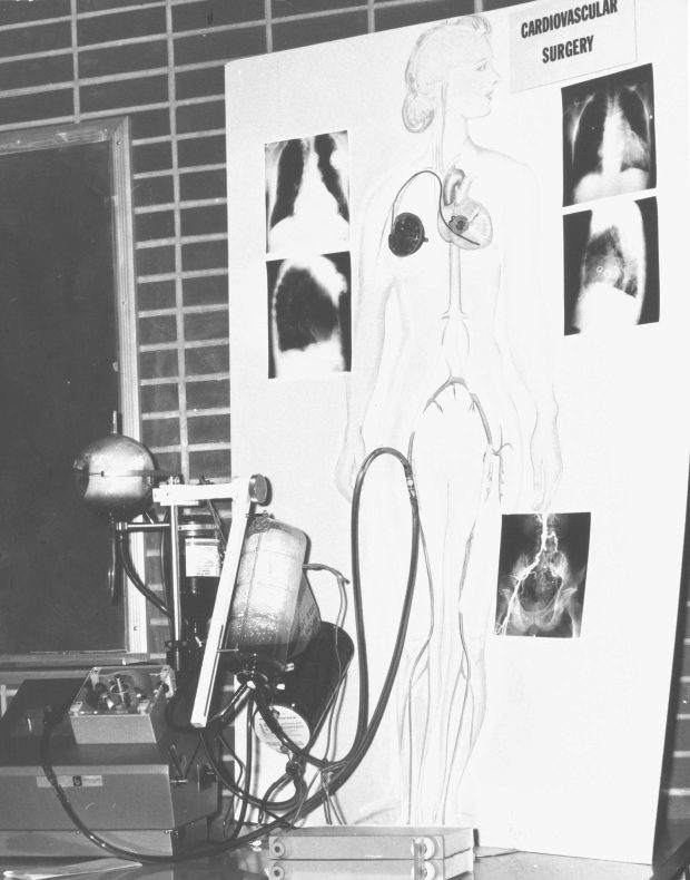Photo en noir et blanc d'une illustration médicale apposée à un dispositif médical de chirurgie cardiovasculaire. Le dessin illustre une femme dont les artères et le cœur sont exposés.