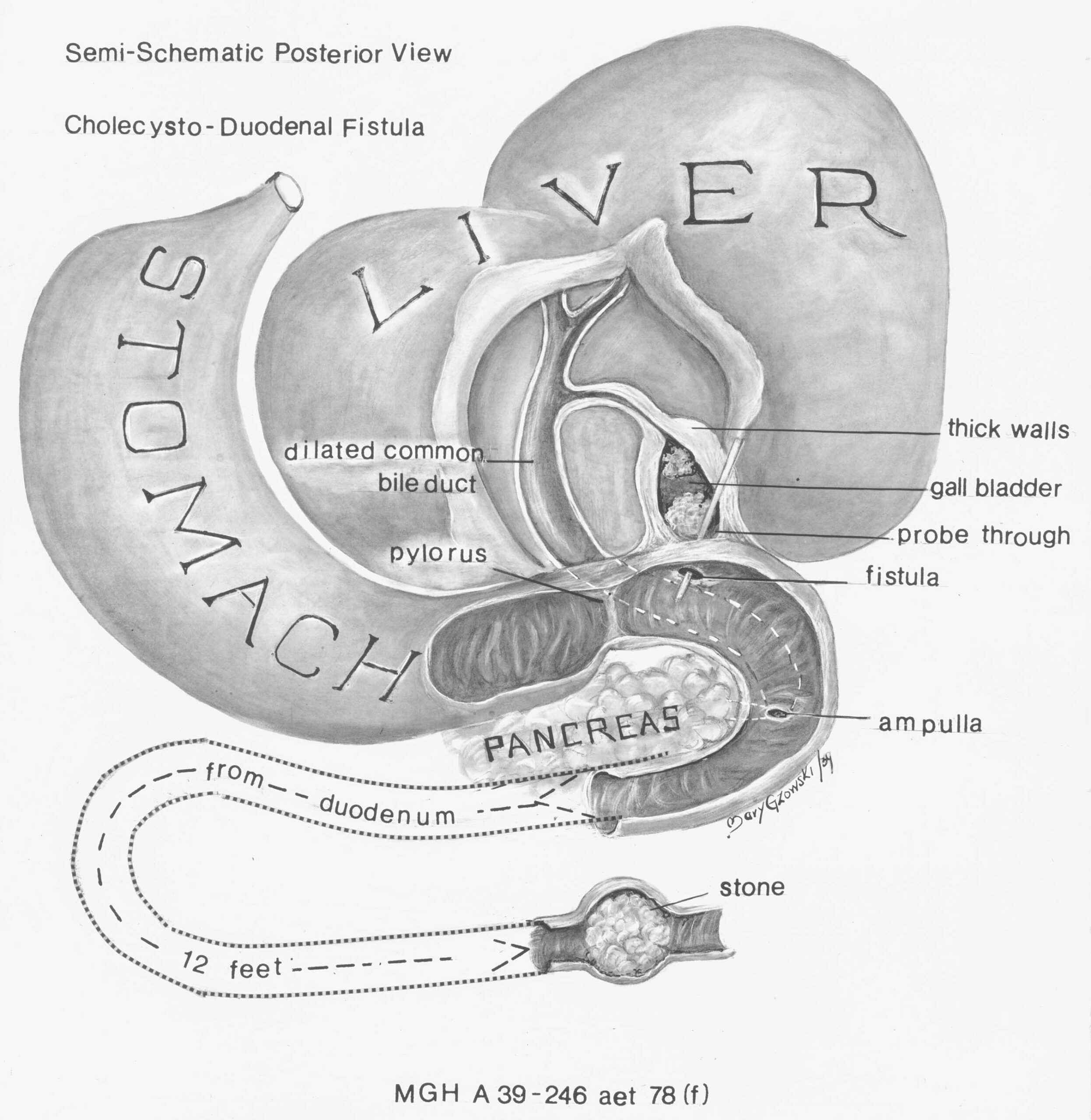 Illustration en noir et blanc montrant le foie, l'estomac et d'autres organes.