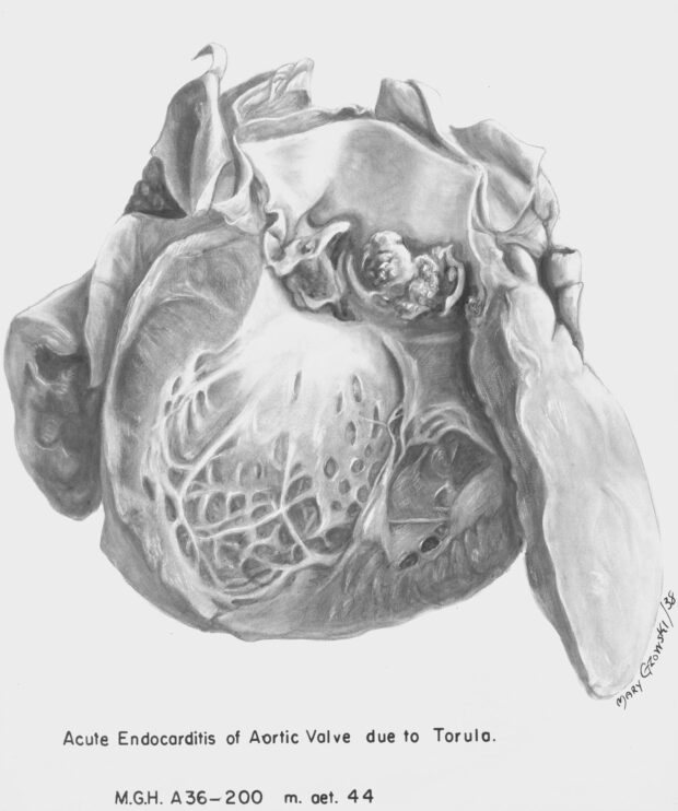Illustration en noir et blanc montrant la valve aortique.