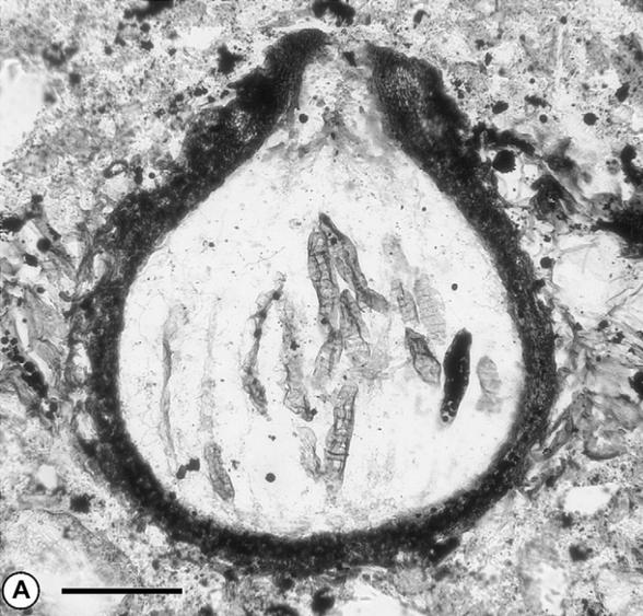 Une photo noir et blanche de M. dictyosporus vu d’un microscope