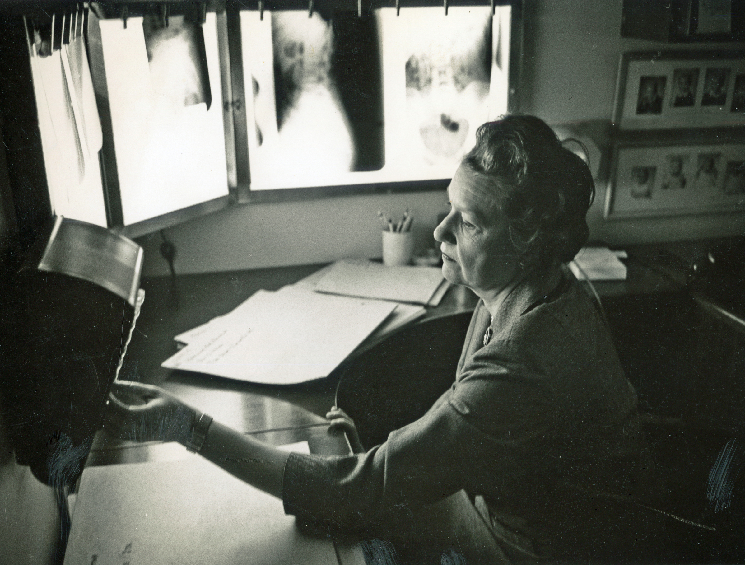 Photo en noir et blanc d’une femme passant un examen radiologique.